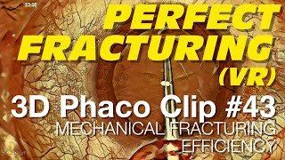 3D Phaco Clip 43  Mechanical Fracturing Efficiency VR Headset Version [upl. by Ducan252]