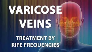 Varicose Veins  RIFE Frequencies Treatment  Energy amp Quantum Medicine with Bioresonance [upl. by Eiramnwad535]