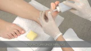 Cómo eliminar los callos de los pies  Tips para pedicuría [upl. by Seabury177]