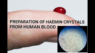 PREPARATION OF HAEMIN CRYSTALS FROM HUMAN BLOOD [upl. by Akemhs]