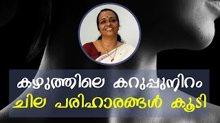 കഴുത്തിലെ കറുപ്പ് മാറ്റാൻ ചില എളുപ്പ മാർഗ്ഗങ്ങൾ  Some easy ways to get rid of black neck [upl. by Adnoel]