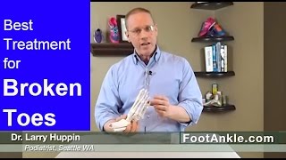 What is the Best Treatment for a Broken Toe and why you should NEVER buddy tape a stubbed toe [upl. by Rezeile]