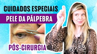 Cuidados especiais no pósoperatório de blefaroplastia [upl. by Werbel138]