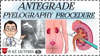 Antegrade pyelogram Antegrade pyelography procedure Alternate of IVP procedure in hindienglish [upl. by Ennaid]