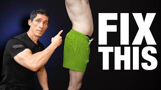 How To Fix Anterior Pelvic Tilt FOREVER [upl. by Ettie]