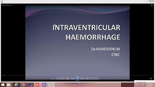 INTRAVENTRICULAR HEMORRHAGE [upl. by Aneekal]