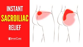 How to Fix Your Sacroiliac Joint Pain  STEPBYSTEP Guide [upl. by Anived566]