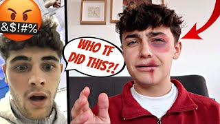 I GOT BEAT UP PRANK ON FIANCE Gay Couple Edition [upl. by Reisinger]