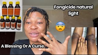 Does Fongicide Dark Knuckles Remover Work My Personal Experience Before and After [upl. by Fiona]