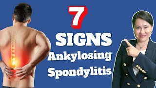 7 Signs of Ankylosing Spondylitis  A Rheumatologist Review [upl. by O'Carroll]