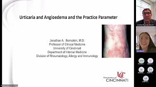 Urticaria and Angioedema Bernstein [upl. by Akinnor]