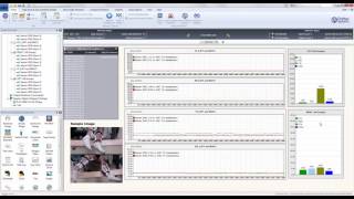 EMG Data Readings  Spinal Cord Injury [upl. by Wiltz]