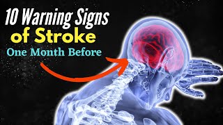 10 Warning Signs of Stroke One Month Before  Unbelievable Signs Revealed [upl. by Annayak]