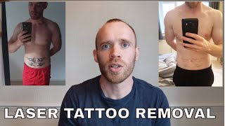 Laser Tattoo Removal  Sessions 1012 Update [upl. by Onairda]