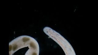 Flatworm With Eggs Under Microscope [upl. by Acinot]