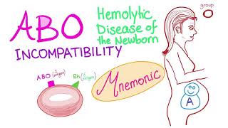 ABO incompatibility mnemonic [upl. by Tamiko]