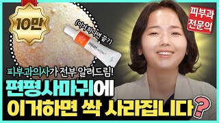 지긋지긋한 편평사마귀 제거해주는 연고가 있다 편평사마귀 제거하는 방법 싹 다 알려드립니다 [upl. by Atinaej497]