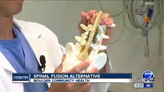 Spinal Fusion Alternative [upl. by Letnohc793]