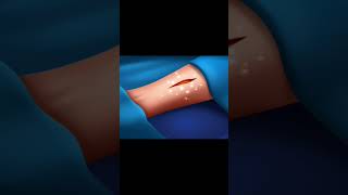 Surgery hospital 3d animation shows video part 10 [upl. by Sirapal]