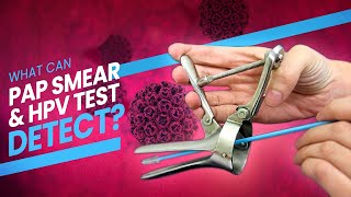 Pap Smear Pap Test and HPV Test  A step by step guide 3D at what happens during the test [upl. by Aisatsanna]