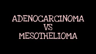 Adenocarcinoma Vs Mesothelioma of lungs Respiratory Pathology [upl. by Adnohsat]