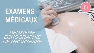 La 2e échographie de grossesse  Examens grossesse [upl. by Atalaya]