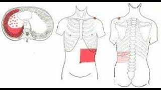 Why Pleurisy pain  Pleuritis pain is referred to the anterior abdominal wall [upl. by Sawyere]