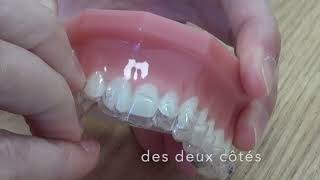 Comment mettre et retirer ses aligners Invisalign [upl. by Nekcarb]