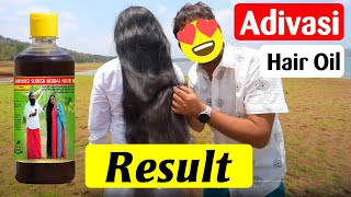 Using Genuine Adivasi Hair Oil and Got SHOCKING Results [upl. by Enimrac]