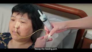 3 Performing Nasogastric Tube NGT Feeding [upl. by Ahsiea]