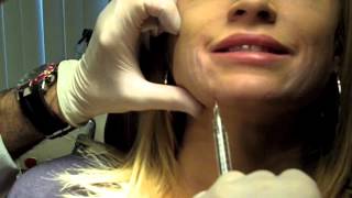 Cannula Method for Fillers  Dr Nissan Pilest Irvine CA [upl. by Naima307]