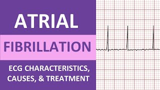 Atrial Fibrillation AFib ECG Treatment Causes Nursing NCLEX Review ACLS [upl. by Diet]