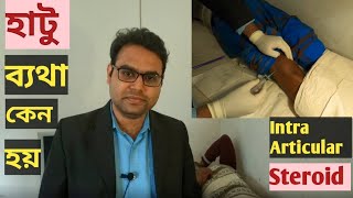 হাঁটু ব্যথা কেন হয় চিকিৎসা কি How to treat knee pain II Intra articular steroid injection [upl. by Edrei905]