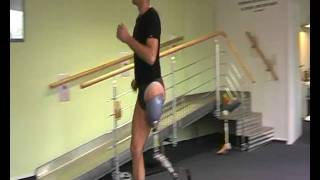 Above knee amputee running on prosthetic leg [upl. by Valleau]