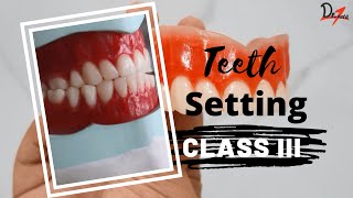 PROSTHODONTICS  Class Three Teeth Arrangement Made Easy [upl. by Airemaj]