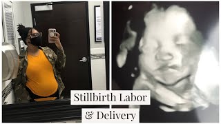 My Stillbirth Story Giving Birth During Covid19 Pandemic [upl. by Daye]