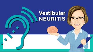 Vestibular Neuritis [upl. by Zaneta]