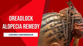 DREADLOCK ALOPECIA REMEDY [upl. by Trevorr511]