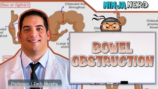 Bowel Obstruction  Clinical Medicine [upl. by Arriet]