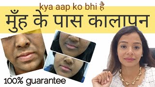 Seborrheic Dermatitis Scalp amp Face l रूसी का बेहतरीन उपाय [upl. by Haik]