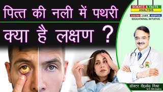 पित की नली में पथरी के क्या है लक्षण  BILE DUCT STONES SYMPTOMS [upl. by Odlanar]