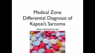 Medical Zone  Differential Diagnosis of Kaposis Sarcoma [upl. by Alikam]