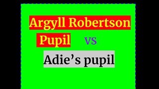 Argyll Robertson pupil VS Adie’s tonic pupil [upl. by Richer]