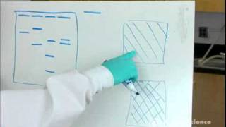 Electrophoresis How to Read Results [upl. by Philcox617]