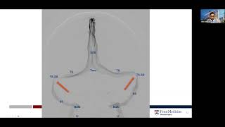 Venous Manometry Explained [upl. by Irok904]