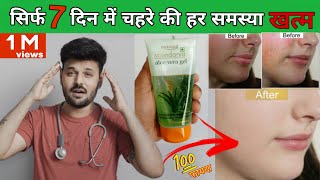 Aloe vera benefits aloe vera gel for face Patanjali saundarya aloe vera gel review [upl. by Ahsemad]