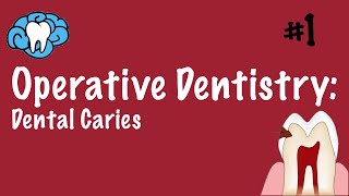 Operative Dentistry  Dental Caries  INBDE ADAT [upl. by Nohsar]