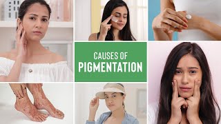 What Is Pigmentation On Face amp What Are The Causes Of Pigmentation  Cosmetologist Explains [upl. by Circosta]