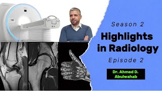 Highlights in Radiology S2 E2 avascular necrosis of the femoral head [upl. by Linad529]