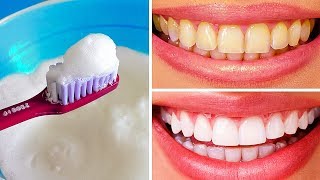 10 Natural Ways to Whiten Teeth at Home [upl. by Celine]